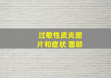 过敏性皮炎图片和症状 面部